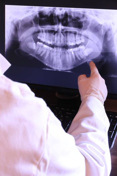 Best Emergency Root Canal Treatment in Footville, WI
