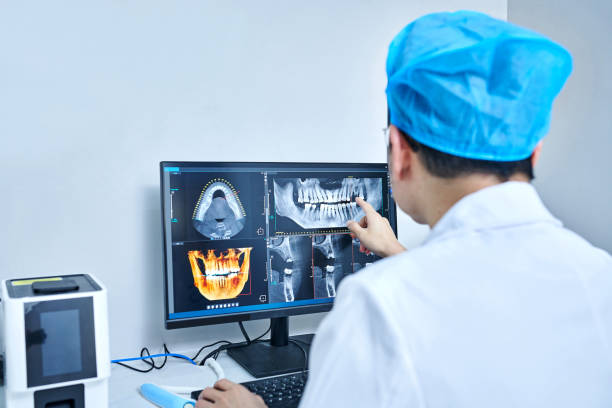 Best Emergency Tooth Extraction in Footville, WI